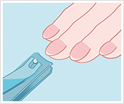 イメージ：爪の状態をチェックします